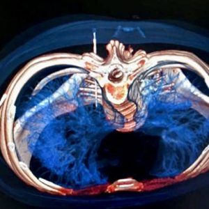 Curso de Actualización de Técnicas de Ganglios