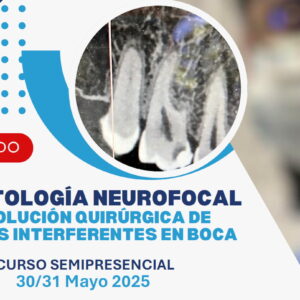 Curso de Resolución Quirúrgica de Campos Interferentes en Boca 2025