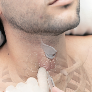Curso de Aplicación Clínica de Terapia Neural