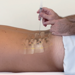 Curso de Técnicas de Ganglios y Plexos Vegetativos en Terapia Neural