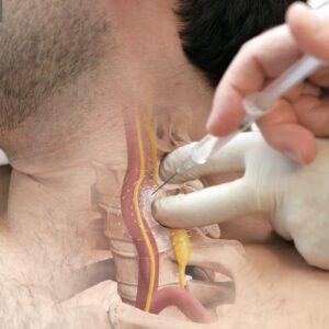 Taller Práctico – Técnica de Ganglios y Plexos Vegetativos